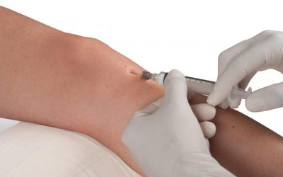 What is prolotherapy?